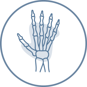 HAND AND UPPER LIMB SURGERY